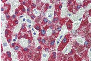 Immunohistochemistry (Formalin-fixed Paraffin-embedded Sections) (IHC (fp)) image for anti-Acyl-CoA Dehydrogenase, C-2 To C-3 Short Chain (Acads) (AA 1-104) antibody (ABIN574013)