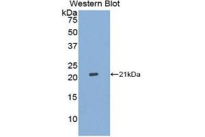 Western Blotting (WB) image for anti-Aconitase 1 (ACO1) (AA 26-189) antibody (ABIN1176781)