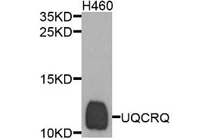 Western blot analysis of extracts of H460 cells, using UQCRQ antibody. (UQCRQ 抗体)