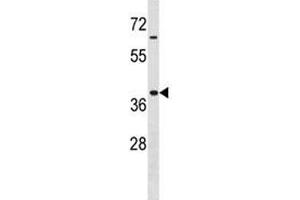 Hoxa9 antibody western blot analysis in MDA-MB453 lysate. (HOXA9 抗体  (AA 160-189))