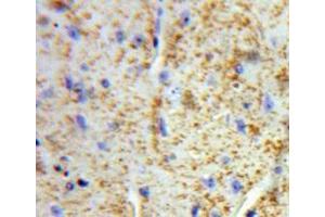 Used in DAB staining on fromalin fixed paraffin-embedded Brain tissue (VWA2 抗体  (AA 457-708))