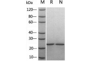 2 μg of FGF-8B, Human  was resolved with SDS-PAGE under reducing (R) and non-reducing (N) conditions and visualized by Coomassie Blue staining. (FGF8 Protein (AA 23-215))