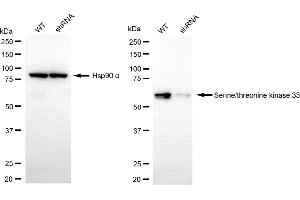 anti-serine/threonine Kinase 33 (STK33) antibody