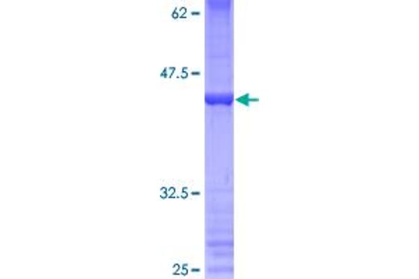 PRDM5 Protein (AA 1-111) (GST tag)