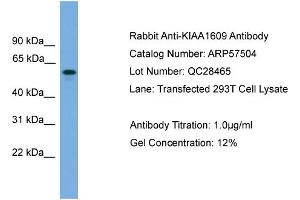 WB Suggested Anti-KIAA1609  Antibody Titration: 0.