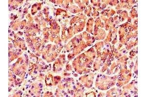Immunohistochemistry of paraffin-embedded human pancreatic tissue using ABIN7173407 at dilution of 1:100 (TNRC6C 抗体  (AA 157-421))