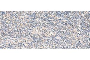 Immunohistochemistry of paraffin-embedded Human tonsil tissue using NEGR1 Polyclonal Antibody at dilution of 1:90(x200) (NEGR1 抗体)