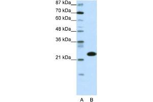 WB Suggested Anti-TAF11 Antibody Titration:  0. (TAF11 抗体  (N-Term))