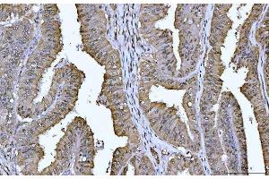 IHC analysis of YWHAE using anti-YWHAE antibody (ABIN7599165).