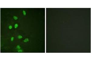 Immunofluorescence analysis of HeLa cells, using CHOP (Ab-30) Antibody. (DDIT3 抗体  (AA 15-64))