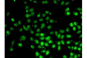 Immunofluorescence analysis of HeLa cell using GABPB1 antibody. (GABPB1 抗体)