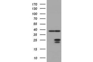 Image no. 1 for anti-Ubiquitin-Conjugating Enzyme E2E 3 (UBE2E3) antibody (ABIN1501623) (UBE2E3 抗体)