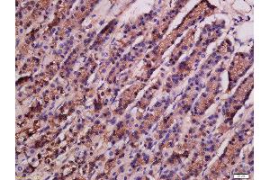 Formalin-fixed and paraffin embedded rat stomach labeled with Rabbit Anti-ATG9A Polyclonal Antibody, Unconjugated  at 1:200 followed by conjugation to the secondary antibody and DAB staining (ATG9A 抗体  (AA 301-400))