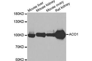 Western blot analysis of extracts of various cell lines, using ACO1 antibody (ABIN5973578) at 1/500 dilution. (Aconitase 1 抗体)