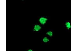Anti-LPL mouse monoclonal antibody (ABIN2455208) immunofluorescent staining of COS7 cells transiently transfected by pCMV6-ENTRY LPL (RC203766). (Lipoprotein Lipase 抗体)