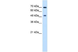 RAD23A antibody used at 2. (RAD23A 抗体)