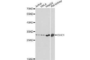 Western blot analysis of extracts of various cell lines, using CLIC1 antibody. (CLIC1 抗体)