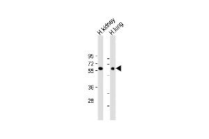 All lanes : Anti-MKS1 Antibody (N-Term) at 1:2000 dilution Lane 1: Human kidney lysate Lane 2: Human lung lysate Lysates/proteins at 20 μg per lane. (MKS1 抗体  (AA 90-124))