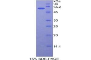 SDS-PAGE analysis of Human ADA Protein. (ADA 蛋白)