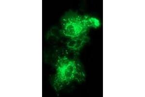 Anti-MMAB mouse monoclonal antibody (ABIN2454036) immunofluorescent staining of COS7 cells transiently transfected by pCMV6-ENTRY MMAB (RC204290). (MMAB 抗体)