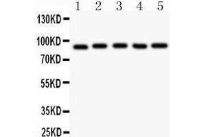 Western Blotting (WB) image for anti-Aryl Hydrocarbon Receptor Nuclear Translocator (ARNT) (AA 416-789) antibody (ABIN3043528) (ARNT 抗体  (AA 416-789))