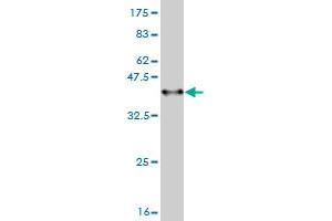 Western Blot detection against Immunogen (36. (ADAM17 抗体  (AA 215-314))