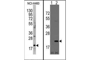 Image no. 1 for anti-Anterior Gradient Homolog 2 (Xenopus Laevis) (AGR2) (AA 102-132) antibody (ABIN358784) (AGR2 抗体  (AA 102-132))