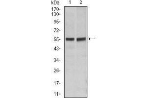 Western blot analysis using FAS antibody against Hela (1), Jurkat (2) cell lysate. (FAS 抗体)