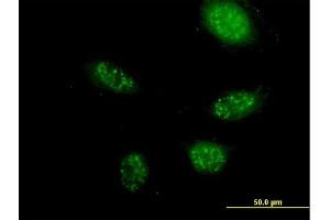 Immunofluorescence of purified MaxPab antibody to ZNF483 on HeLa cell.