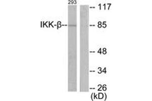 Western blot analysis of extracts from 293 cells, treated with LPS 100ng/ml 30', using IKK-beta (Ab-188) Antibody. (IKBKB 抗体  (AA 161-210))