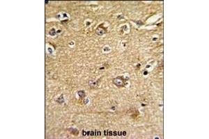 Formalin-fixed and paraffin-embedded human brain tissue reacted with IT Antibody (Center), which was peroxidase-conjugated to the secondary antibody, followed by DAB staining. (IMMT 抗体  (AA 438-467))