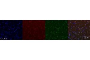 Immunohistochemistry (IHC) image for anti-Nuclear Receptor Subfamily 4, Group A, Member 2 (NR4A2) antibody (ABIN7456241) (NR4A2 抗体)