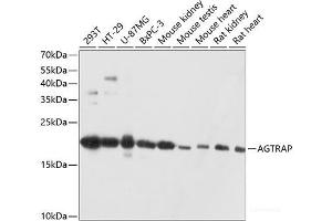 Western blot analysis of extracts of various cell lines using AGTRAP Polyclonal Antibody at dilution of 1:3000. (AGTRAP 抗体)