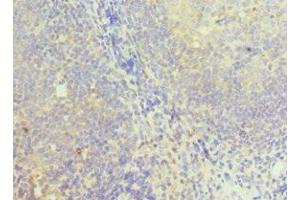 Immunohistochemistry of paraffin-embedded human tonsil tissue using ABIN7149352 at dilution of 1:100 (NCK1 抗体  (AA 58-377))
