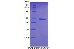 SDS-PAGE (SDS) image for Cytochrome P450, Family 26, Subfamily A, Polypeptide 1 (CYP26A1) protein (ABIN3009110)