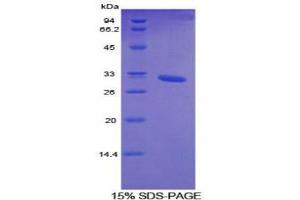 SDS-PAGE analysis of Mouse Cytochrome P450 26A1 Protein. (CYP26A1 蛋白)