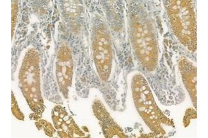 ABIN6262007 and ABIN6277326 at 1/100 staining human normal colon tissue by IHC-P.