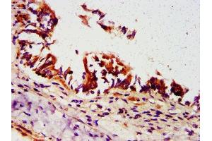 IHC image of ABIN7162284 diluted at 1:500 and staining in paraffin-embedded human lung tissue performed on a Leica BondTM system.