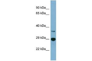 WB Suggested Anti-BDH2 Antibody Titration: 0. (BDH2 抗体  (Middle Region))