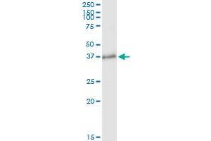 Immunoprecipitation of BCL11A transfected lysate using anti-BCL11A MaxPab rabbit polyclonal antibody and Protein A Magnetic Bead , and immunoblotted with BCL11A purified MaxPab mouse polyclonal antibody (B01P) . (BCL11A 抗体  (AA 1-243))