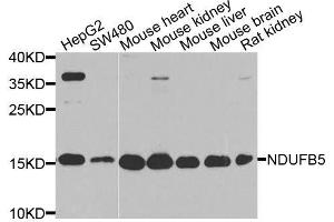 Western blot analysis of extracts of various cell lines, using NDUFB5 antibody. (NDUFB5 抗体  (AA 100-189))