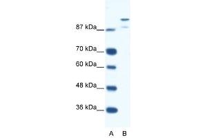 HKR1 antibody (20R-1118) used at 1. (HKR1 抗体  (N-Term))
