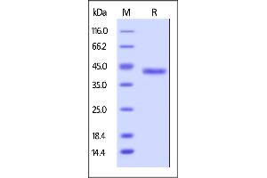 Human Galectin-4, His Tag on  under reducing (R) condition.