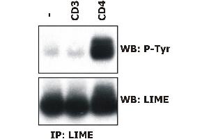 Induction of LIME tyrosine phosphorylation. (LIME 抗体  (AA 141-295))