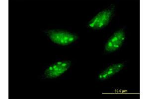 Immunofluorescence of monoclonal antibody to MEOX1 on HeLa cell. (MEOX1 抗体  (AA 165-252))