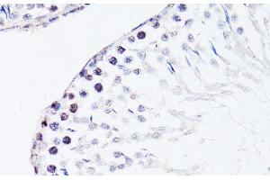 Immunohistochemistry of paraffin-embedded Rat testis using FGF12 Polyclonal Antibody at dilution of 1:150 (40x lens). (FGF12 抗体)