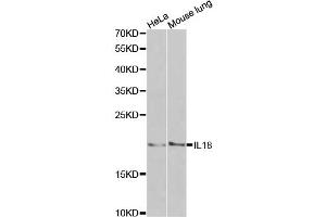 Western blot analysis of extracts of various cell lines, using IL18 antibody. (IL-18 抗体)