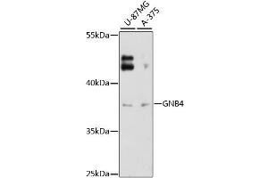 Western blot analysis of extracts of various cell lines, using GNB4 antibody (ABIN6293322) at 1:3000 dilution. (GNB4 抗体)