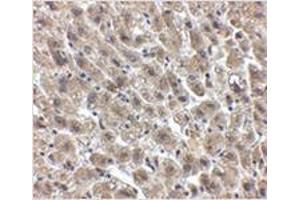 Immunohistochemistry of Albumin in human liver tissue with Albumin antibody at 2. (Albumin 抗体  (Center))