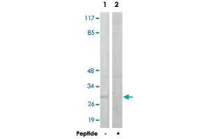 Western blot analysis of extracts from HUVEC cells, using IGFBP3 polyclonal antibody .